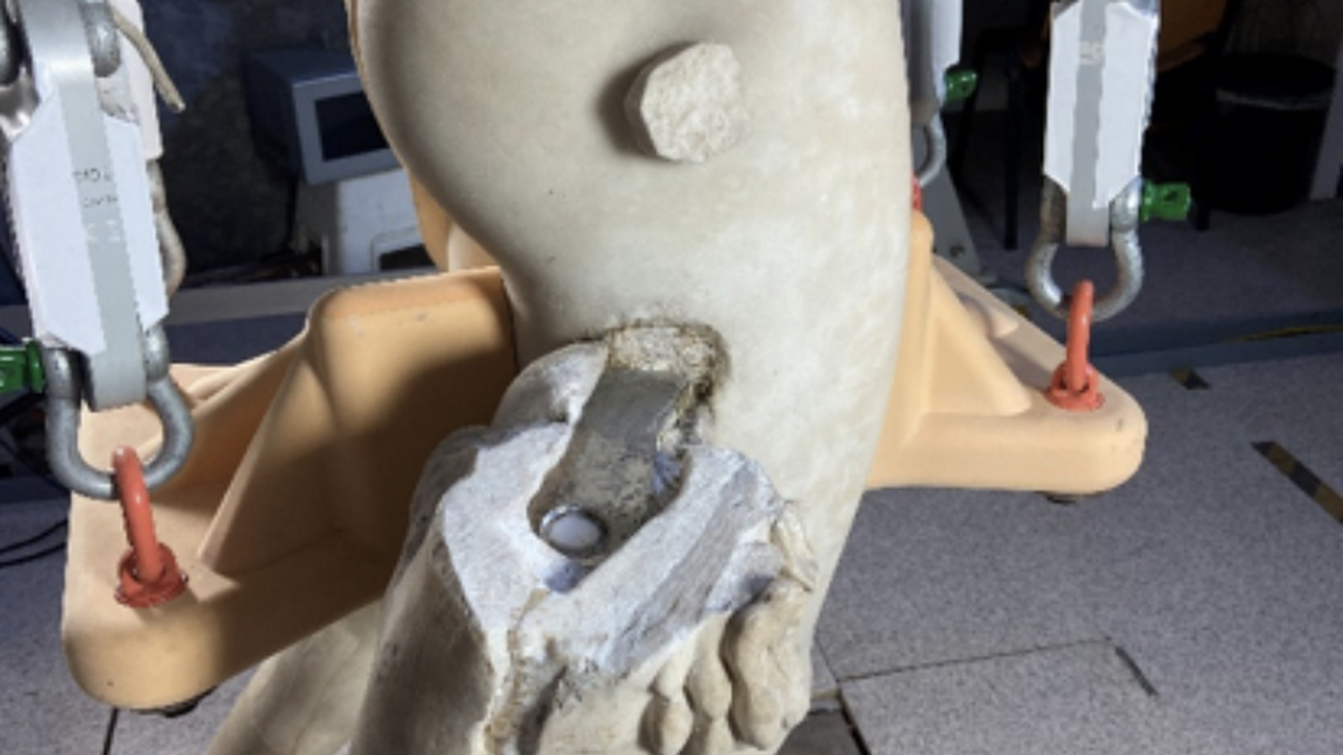 3 Apollo del Belvedere - Second Ongoing Restoration Report